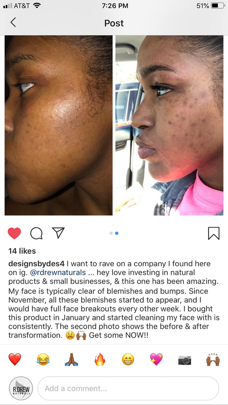 Clear Skin = Confident You!!