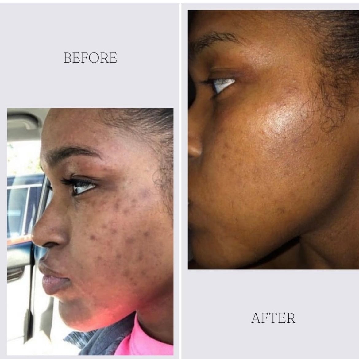 Clear Skin Facial Wash - R. Drew Naturals