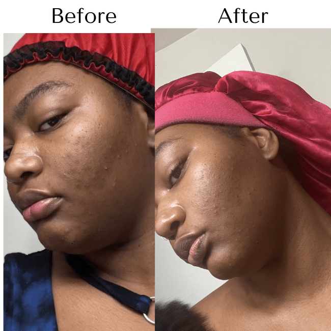 Clear Skin Facial Toner R Drew Naturals