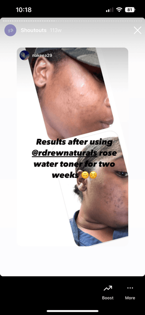 Rosewater & Aloe Facial Toner - R. Drew Naturals